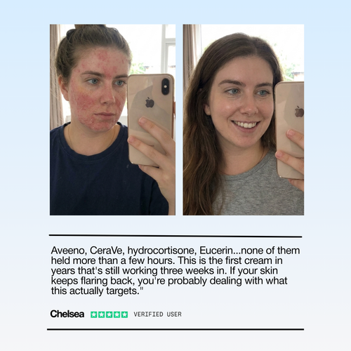 The Sea Cleared My Eczema™ daily defence cream for dry, itchy skin – 120g