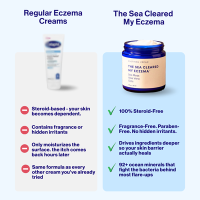 The Sea Cleared My Eczema™ daily defence cream for dry, itchy skin – 120g