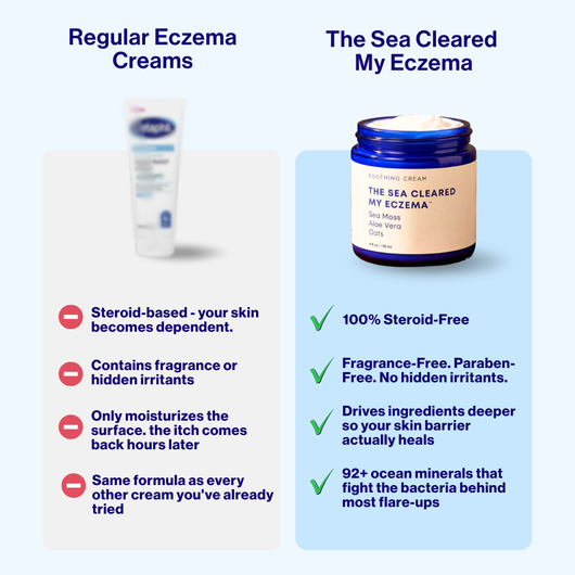 The Sea Cleared My Eczema™ daily defence cream for dry, itchy skin – 120g