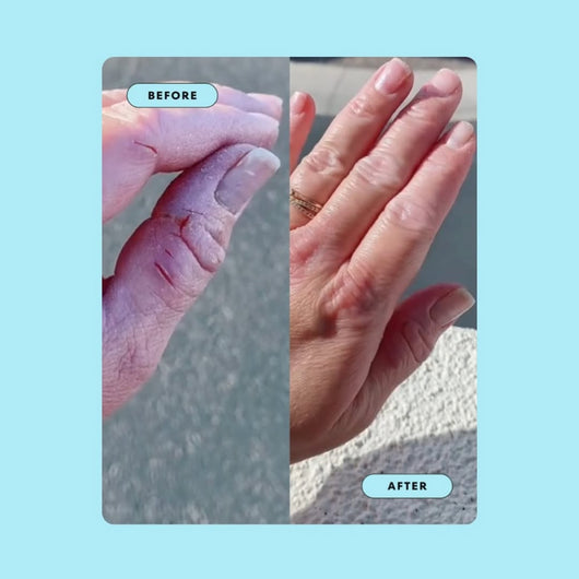The Sea Cleared My Eczema™ daily defence cream for dry, itchy skin – 120g